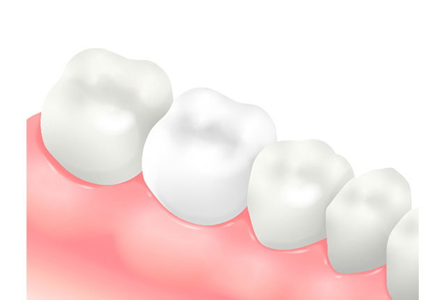 ジルコニアクラウン